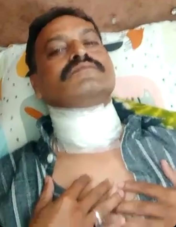 लखनऊ में मांझे ने सचिवालय कर्मी की गर्दन काटी, गंभीर घायल 